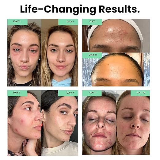 Filterbaby 1.0 Faucet - Mounted Water Filter for Skin Care - Hydrate & Brighten Skin While it Cleans - Fits Most Standard US Faucets - Three Settings (Pink)